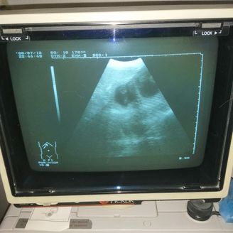 3 Ultraschall